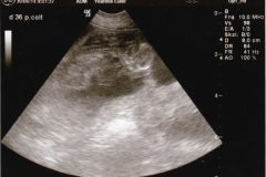 2014-06-30 B-Wurf Ultraschall